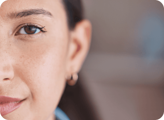 ye naevus (eye freckle)