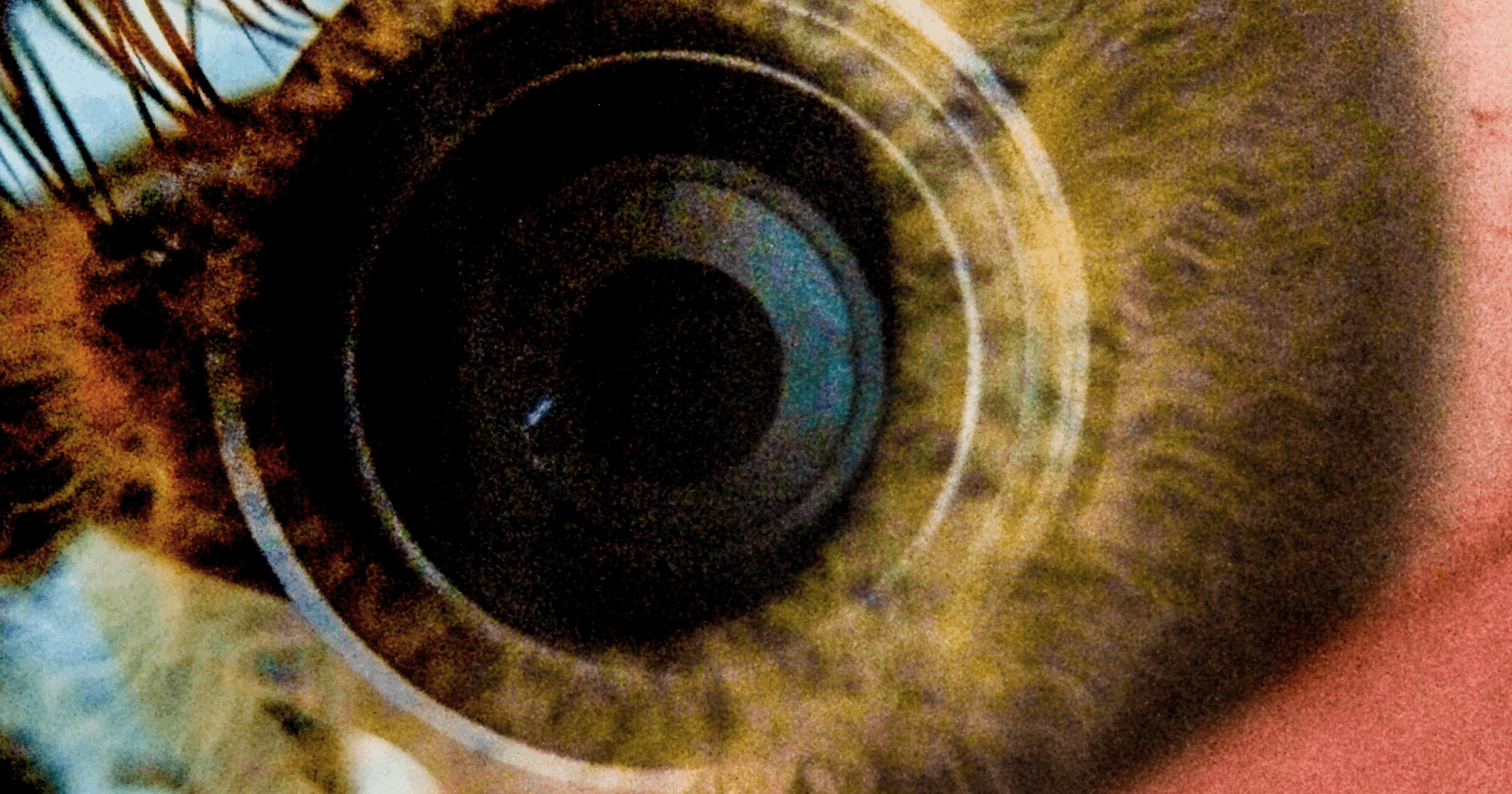 Oculoplastic & Reconstructive Surgery | Eagle Eye Centre