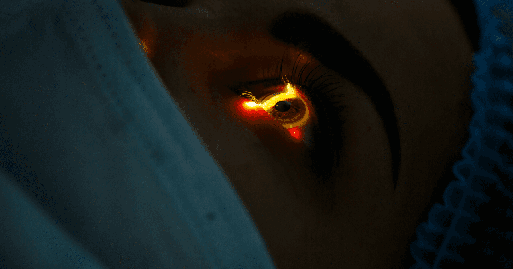 YAG Laser Capsulotomy | Eagle Eye Centre