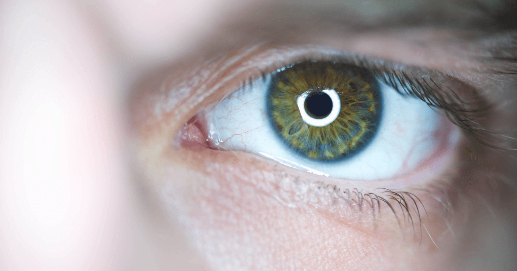 Pterygium Treatment | Eagle Eye Centre