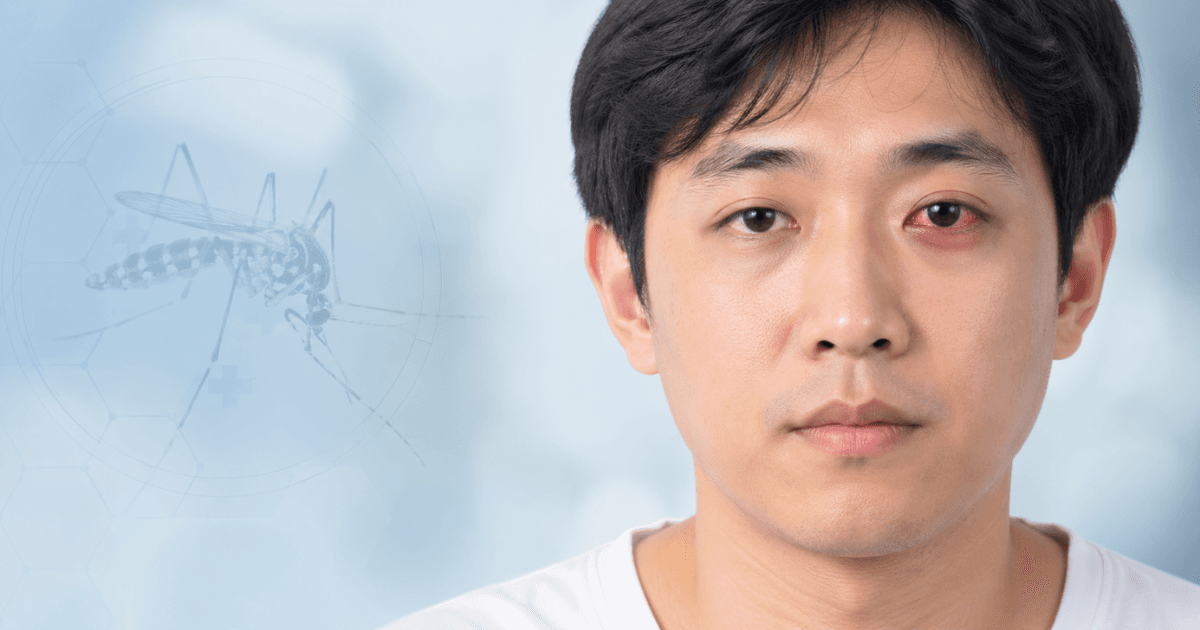 Asian adult with red eye illustrating Zika virus and eye complications