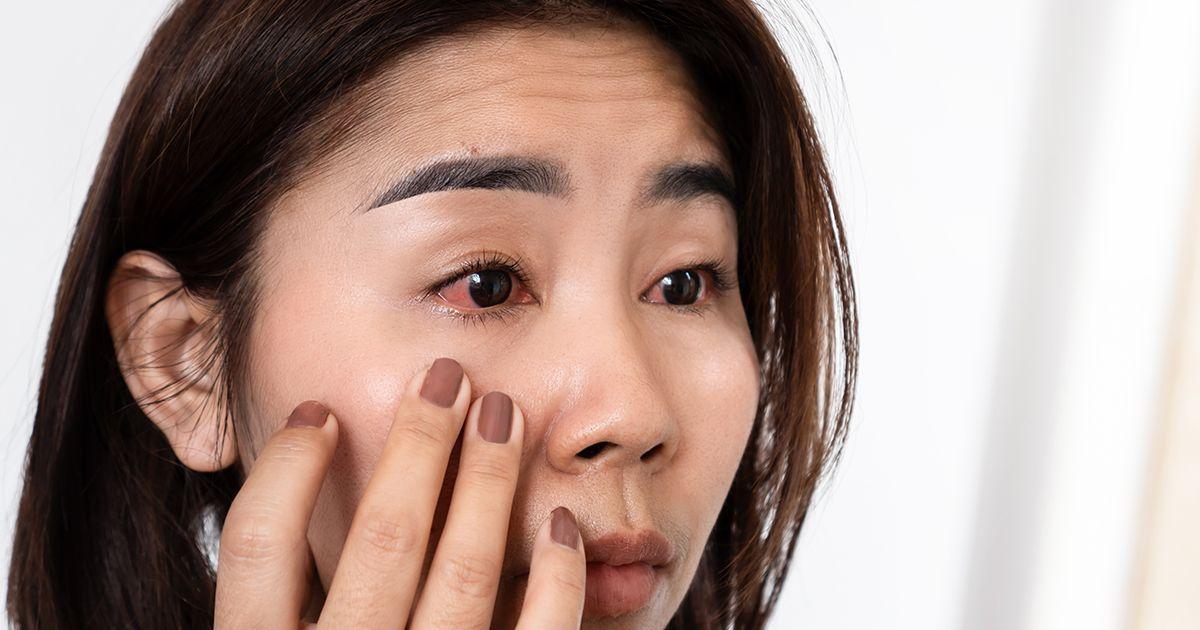 lady with eye inflammation checking her eyes