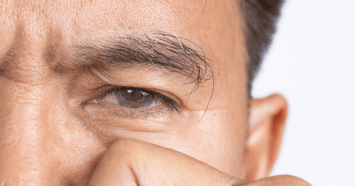 Middle-aged Asian patient has symptoms of ocular inflammation