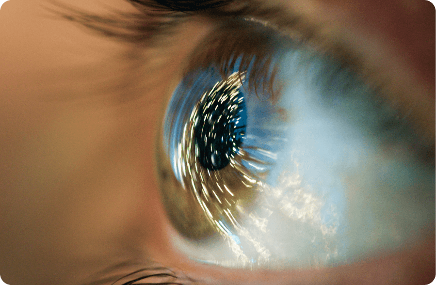 Ptk Procedure Phototherapeutic Keratectomy (PTK) | Eagle Eye Centre